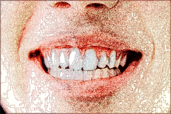 2024河北省口腔醫(yī)院種牙價目表(價格表)怎么樣