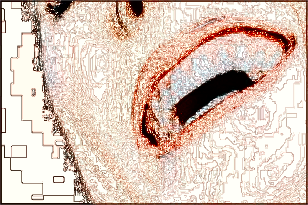 河北省口腔醫(yī)院全瓷貼面怎么樣_全瓷貼面對(duì)牙齒傷害大嗎