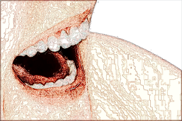 河北省口腔醫(yī)院烤瓷牙多少錢_烤瓷牙和全瓷牙的區(qū)別哪個好