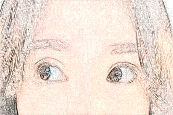 六安市人民醫(yī)院激光祛斑是怎么收費的【激光祛斑案例】