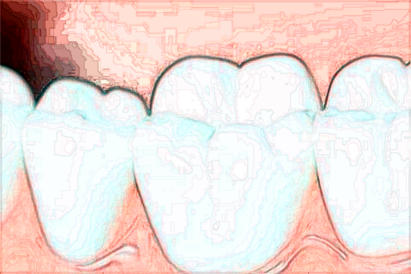 2024北大口腔醫(yī)院正頜怎么樣_哪些醫(yī)生做的比較好