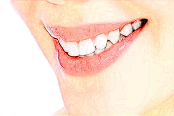 河北省口腔醫(yī)院種植牙技術(shù)怎么樣【種植牙案例】