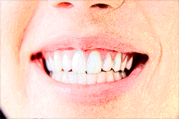 河北省口腔醫(yī)院正頜收費(fèi)標(biāo)準(zhǔn)_哪個(gè)醫(yī)生做的好