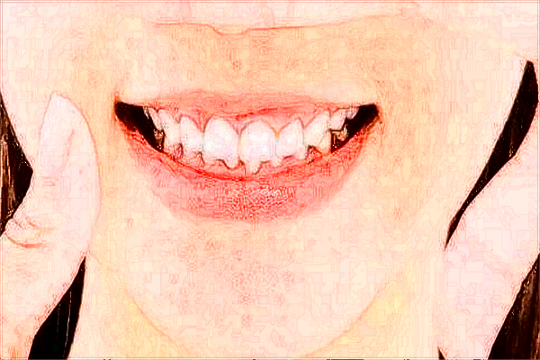 河北省口腔醫(yī)院正頜收費(fèi)標(biāo)準(zhǔn)_哪個(gè)醫(yī)生做的好