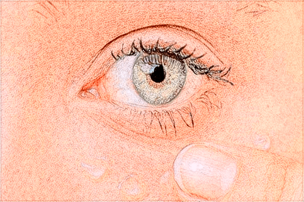 泰安市中醫(yī)二院眼部修復(fù)好嗎?2024眼部修復(fù)價(jià)格曝光