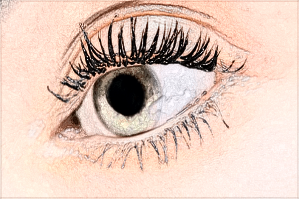 河科大二附院去眼袋技術(shù)怎么樣?2024去眼袋手術(shù)價格