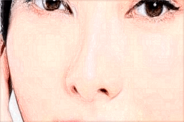 泰安市中醫(yī)二院鼻孔縮小好嗎?鼻孔縮小收費價格2024