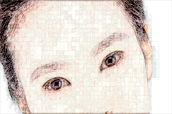 2024上海同濟(jì)醫(yī)院祛疤案例_做的怎么樣