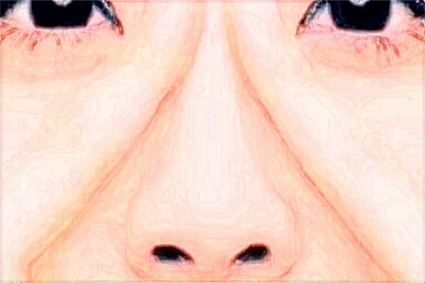 2024成都華西醫(yī)院價(jià)格表_做的怎么樣