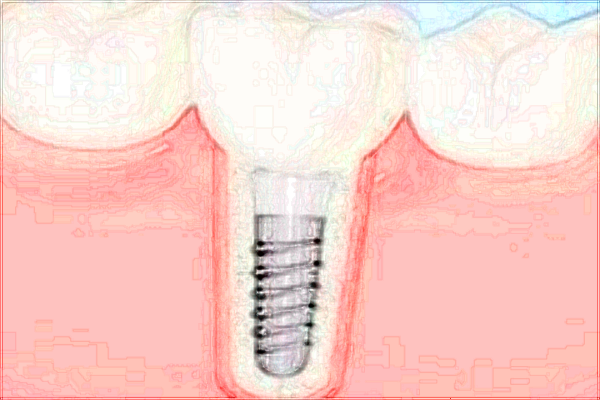 2024成都華西醫(yī)院口腔科牙科醫(yī)生名單_技術(shù)怎么樣