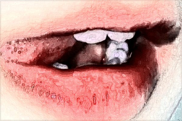 寧波二院種植牙怎么樣?寧波二院2024種植牙收費(fèi)價格