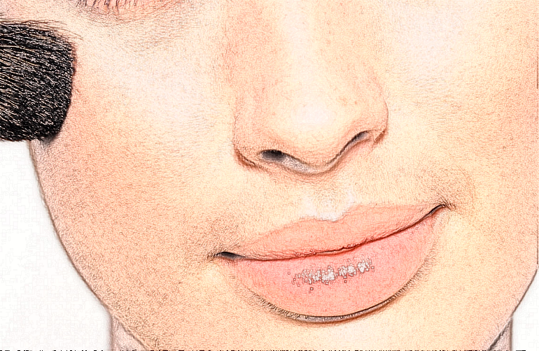 河北醫(yī)科大學(xué)第一醫(yī)院光子嫩膚價格多少_做的怎么樣