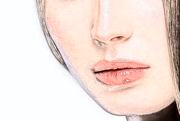 寧波李惠利醫(yī)院整形科可以去除鼻子注射物嗎