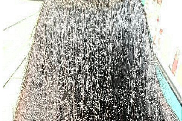 上海同濟(jì)醫(yī)院植發(fā)那個(gè)醫(yī)生做的好_做的怎么樣