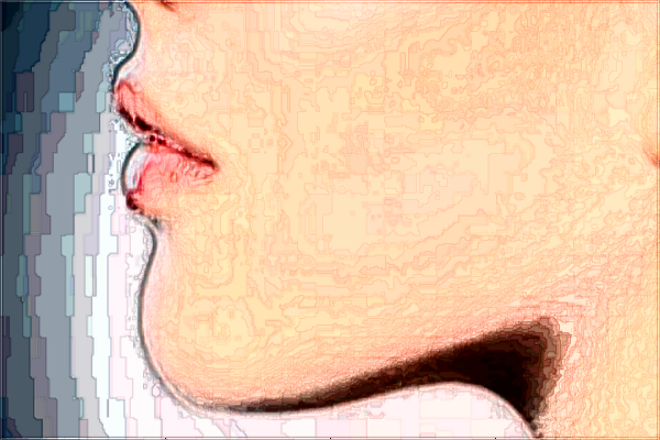 成都華西醫(yī)院墊下巴價(jià)目表(價(jià)格表)怎么樣