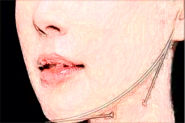 2024成都華西醫(yī)院熱瑪吉怎么樣_哪些醫(yī)生做的比較好