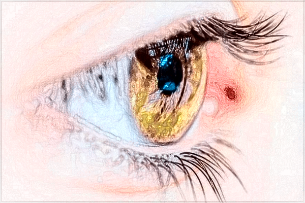 南昌大學(xué)第一附屬醫(yī)院雙眼皮怎樣?2024雙眼皮手術(shù)價(jià)格