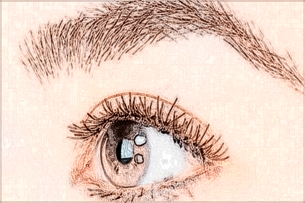 2024無錫市第二人民醫(yī)院去眼袋做的怎么樣_案例+價(jià)格