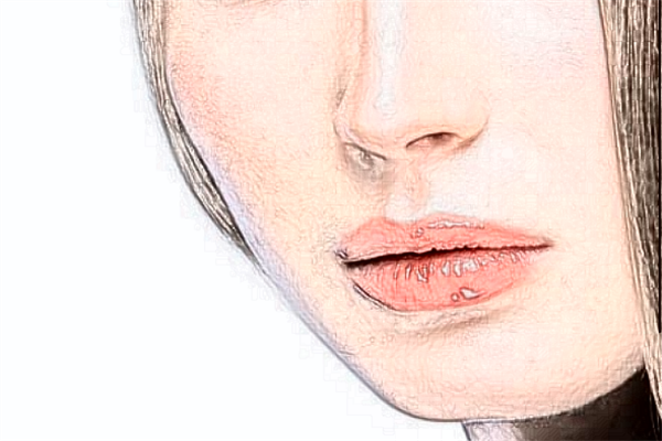 上海同濟(jì)醫(yī)院去痣怎么樣_案例+價格