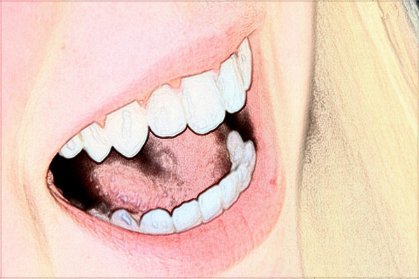 2024江蘇省口腔醫(yī)院牙齒美白做的好嗎_技術(shù)怎么樣