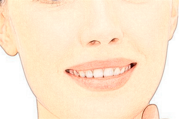 溫州醫(yī)學(xué)院附屬第一醫(yī)院祛斑怎么樣_大概需要多少錢