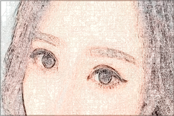 寧波李惠利醫(yī)院激光去痘印價(jià)目表(價(jià)格表)怎么樣