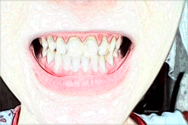 淮北市人民醫(yī)院牙科醫(yī)生名單介紹【附案例】