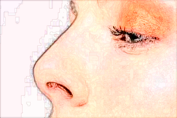 北京大學(xué)第一醫(yī)院整形科醫(yī)生名單簡(jiǎn)介+價(jià)格