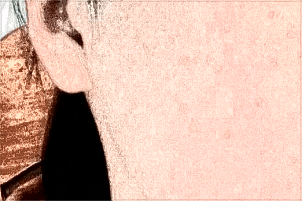 九江學院附屬醫(yī)院激光美容科怎么樣?激光美容科怎么收費