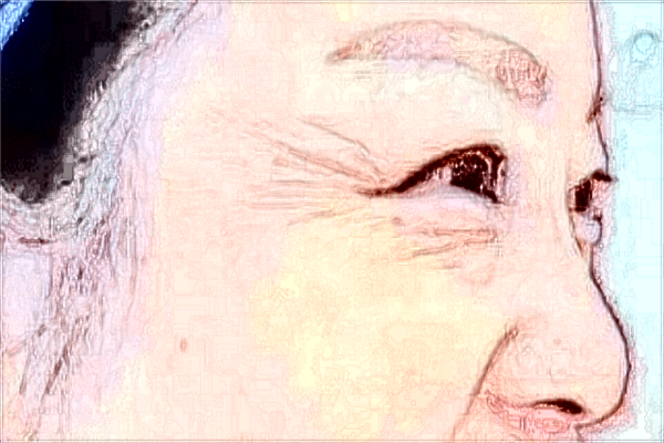 2024南昌大學第二附屬醫(yī)院祛斑多少錢?祛斑后多久恢復正常