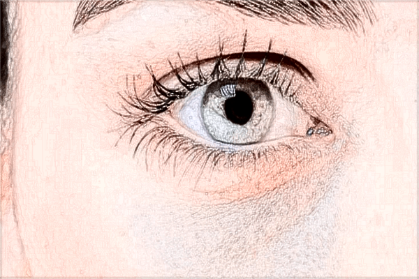 南昌大學第二附屬醫(yī)院激光近視大概多少錢?激光近視后遺癥