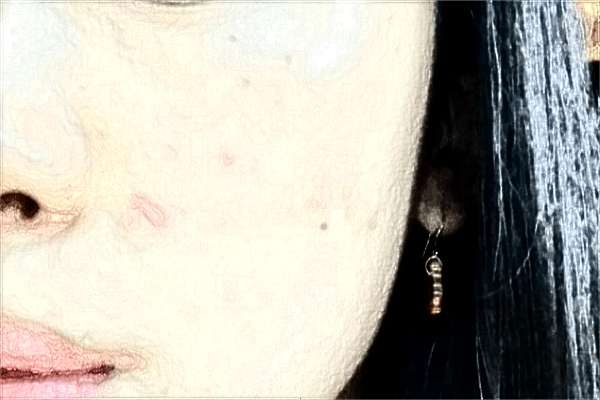 南昌大學(xué)第二附屬醫(yī)院祛斑怎么樣?2024激光祛斑需要多少錢