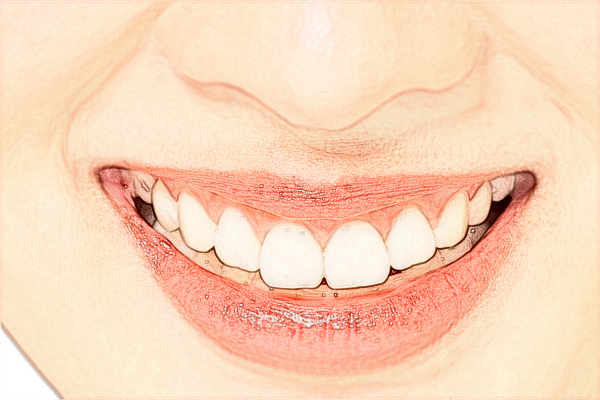 江蘇省口腔醫(yī)院烤瓷牙做的怎么樣_哪位醫(yī)生做的不錯