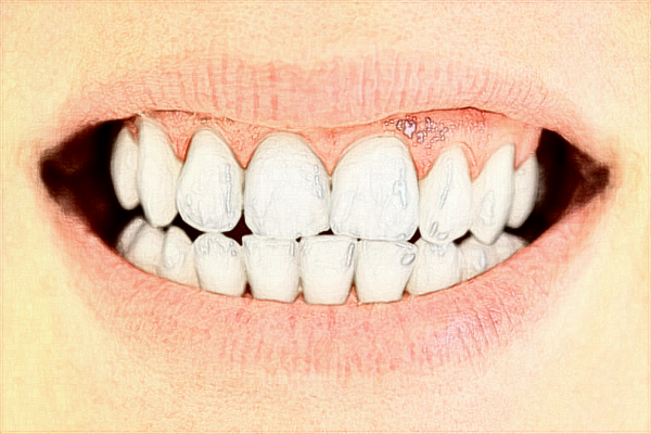 蘇州大學(xué)附屬第一醫(yī)院整牙價(jià)目表(價(jià)格表)怎么樣