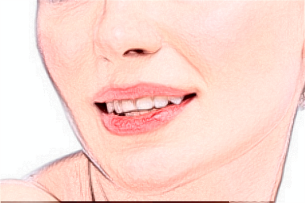 寧波李惠利醫(yī)院光子嫩膚做的好嗎_哪位醫(yī)生做的好