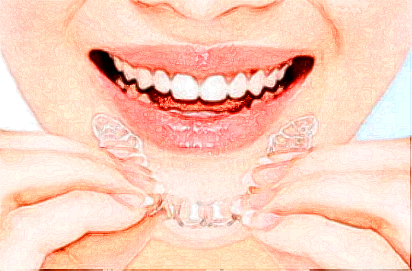 2024江蘇省口腔醫(yī)院瓷貼面怎么樣_案例+價(jià)格