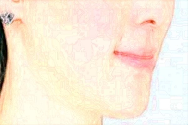 2024上海東方醫(yī)院去痣怎么樣