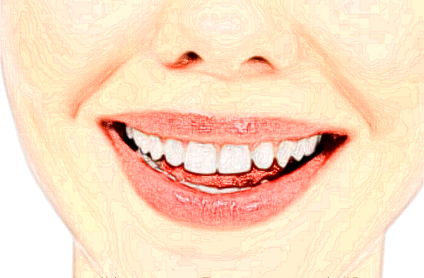 江蘇省口腔醫(yī)院隱適美怎么樣_哪個(gè)醫(yī)生做得好