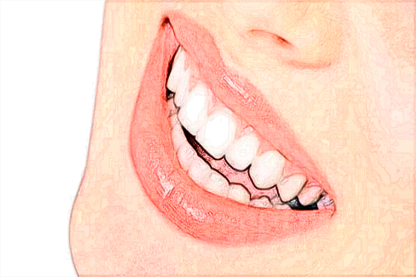 無錫市第二人民醫(yī)院牙科怎么樣_附醫(yī)生名單