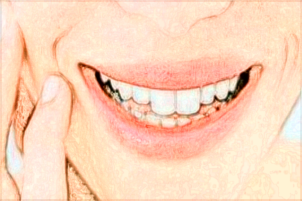 無錫市第二人民醫(yī)院種植牙價(jià)格多少_醫(yī)生技術(shù)怎么樣