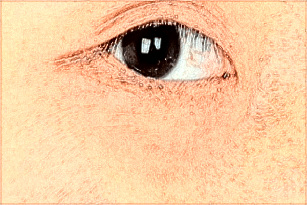 2024贛州市人民醫(yī)院祛斑多少錢?激光祛斑怎么樣