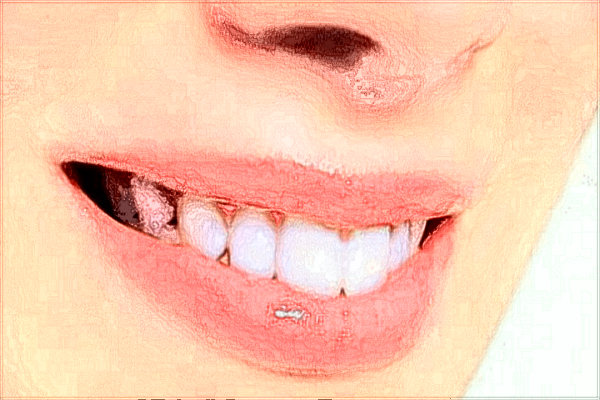 2024贛州市人民醫(yī)院牙齒矯正怎么樣?牙齒矯正要花費(fèi)多少