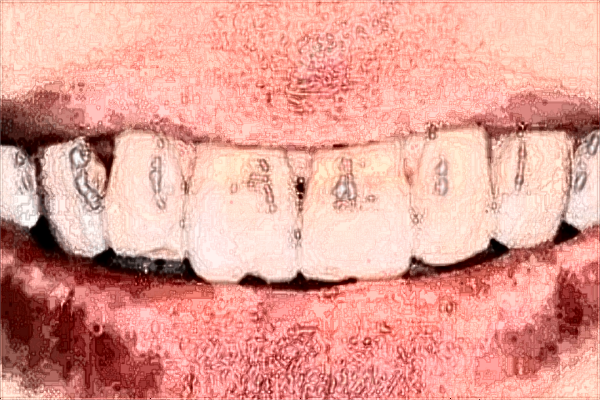 贛州市人民醫(yī)院牙科醫(yī)生名單?2024牙科收費(fèi)價(jià)目表