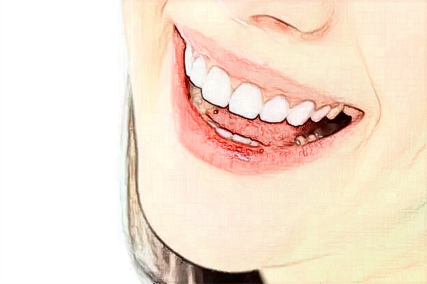 四川大學(xué)華西口腔醫(yī)院牙齒種植做的怎么樣_醫(yī)生名單推薦