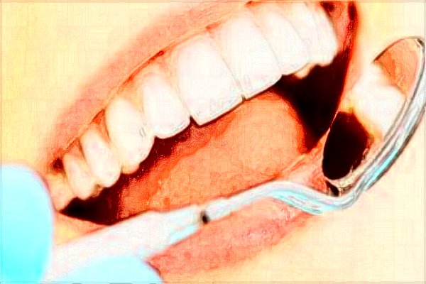 2024昆明市延安醫(yī)院種一顆牙需要多少錢(qián)?種牙好嗎?