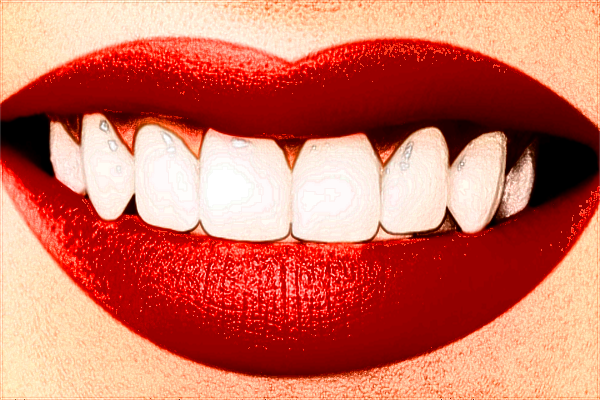 河北醫(yī)科大學口腔醫(yī)院隱形牙套多少錢_隱形牙套的矯正原理