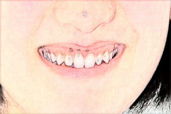 2024常州市第一人民醫(yī)院牙齒根管怎么樣_哪個醫(yī)生比較有名氣