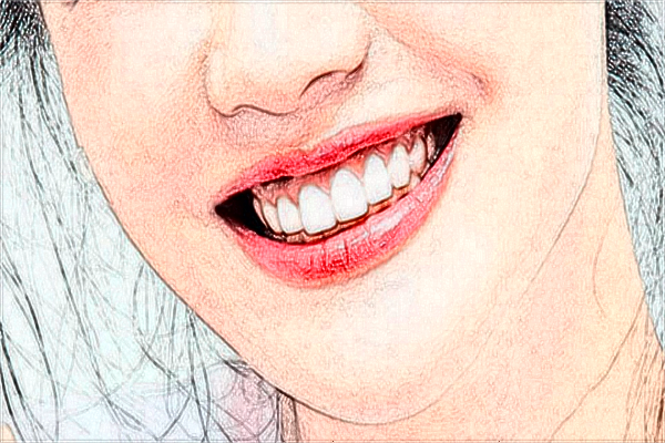 2024重慶醫(yī)科大學(xué)附屬口腔醫(yī)院全口義齒怎么樣_案例+價格