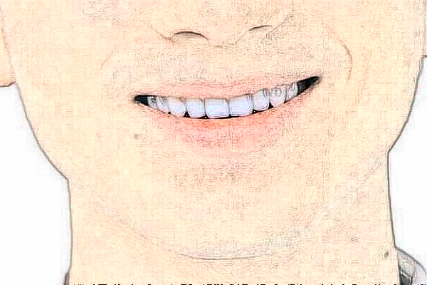 2024重慶醫(yī)科大學(xué)附屬口腔醫(yī)院補(bǔ)牙哪個醫(yī)生好_做的怎么樣