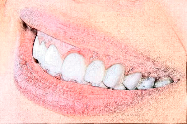 重慶醫(yī)科大學附屬口腔醫(yī)院烤瓷牙怎么樣_哪個醫(yī)生比較有名氣